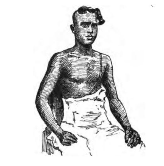 1883 sketch depicting a Nambūdiri man with the traditional pūrvaśikhā, or forelock
