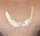 Caste-mark of the Vadamas